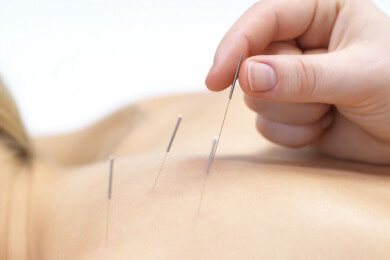 Forscher untersuchen die Wirkung der Akupunktur zur Linderung der Übelkeit wähend einer Chemo