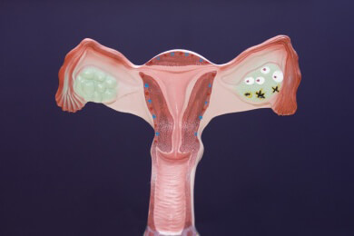 Echte Hoffnung für Patientinnen mit Vulva-Krebs