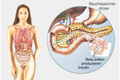 Wenig Schlaf und Nachtarbeit stören den Insulinhaushalt - mehr Diabetes und Übergewicht