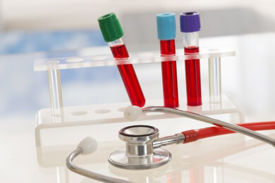 Blutplasma untersucht: Eher Ketchup als Wasser