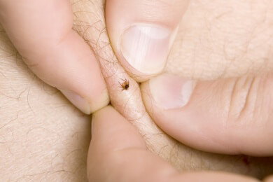 Zeckenbisse richtig behandeln - Am besten mit Zeckenzange oder Pinzette entfernen