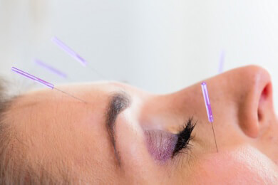 Behandlung mit Placebos: Tabletten oder Akupunktur