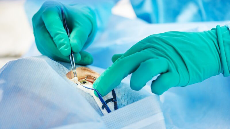 Chirurg in grünen Handschuhen bei einer Augenoperation - Laser-in-situ-Keratomileusis (LASIK)