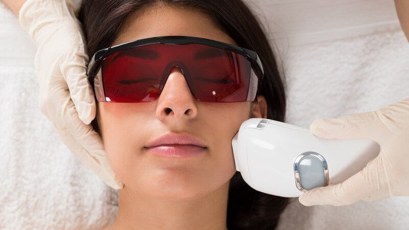 Frau mit Schutzbrille bekommt eine Laserepilation im Gesicht