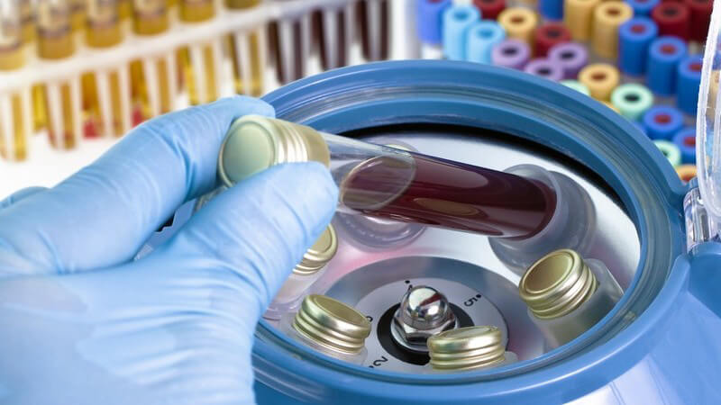 Laborant mit blauem Handschuh steckt ein Reagenzglas mit Blut in eine Zentrifuge im Labor