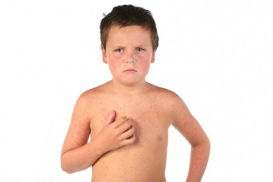 Forscher präsentieren neue Erkenntnisse zu gängigen Hautproblemen