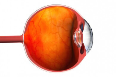 Neues Verfahren der Augenoperation