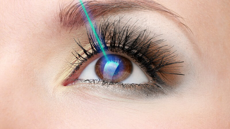 Lasertherapie zur Sehkorrektur - Laserstrahl wird auf Auge gerichtet