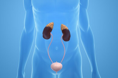 Vorbeugen von Nierensteinen durch eine gesunde Ernährung