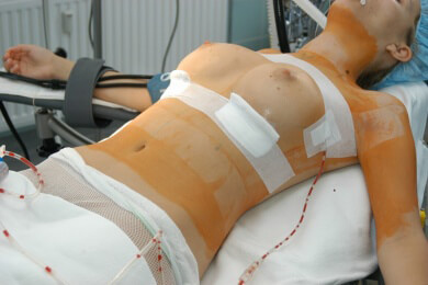 Billig-Implantate aus Frankreich: Frau verklagt TÜV Rheinland und wird abgewiesen