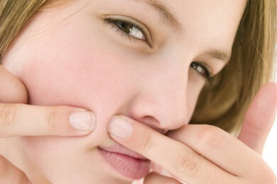 Milch und Süßigkeiten können Akne noch verschlimmern