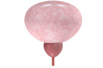 Schlingenoperation statt Beckenbodentraining: Umdenken bei Harninkontinenz gefordert