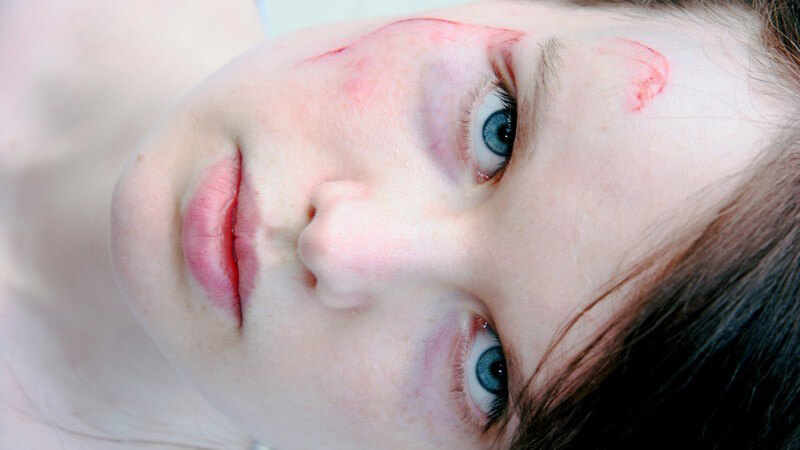 Junge Frau mit Blutergüssen im Gesicht schaut verletzt und wütend in Kamera
