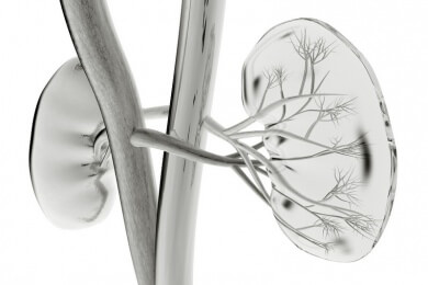 Stents zur Prävention? Einer Stenose in der Nierenarterie kann so nicht vorgebeugt werden