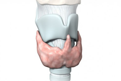 Hoffnung für Patienten mit gelähmten Stimmbändern: Kehlkopfschrittmacher soll das Atmen erleichtern