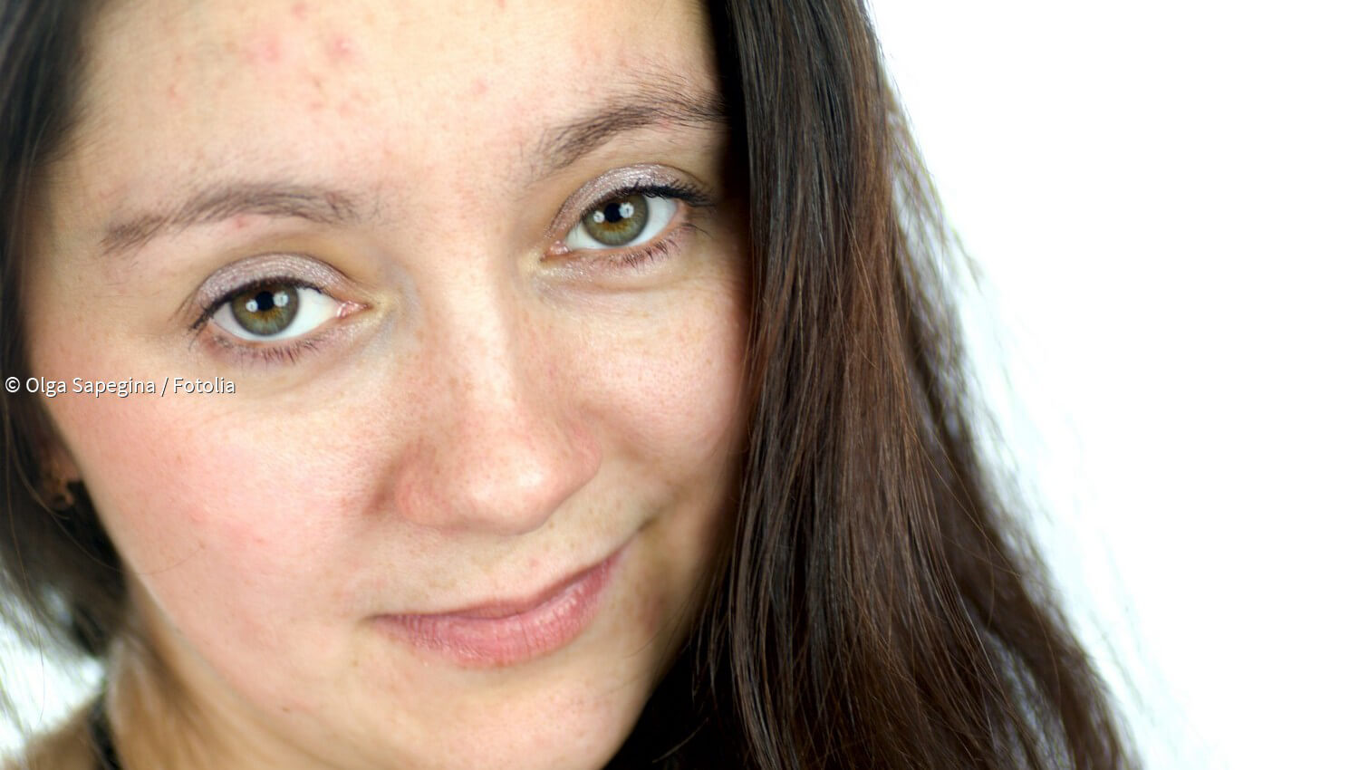 Kurzmeldungen zum Thema Erröten paradisi.de