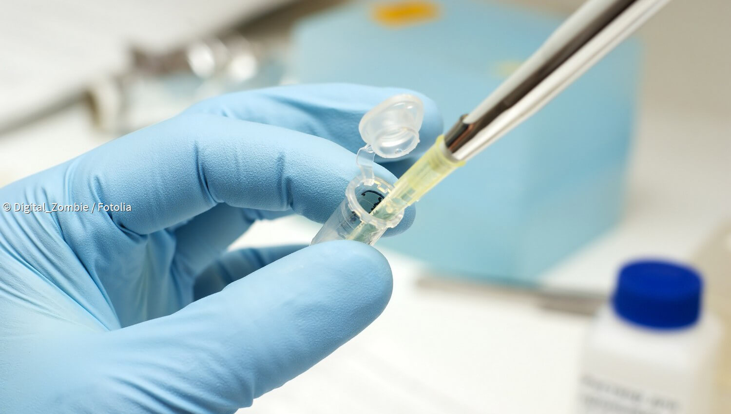 Kurzmeldungen zum Thema Gentest paradisi.de